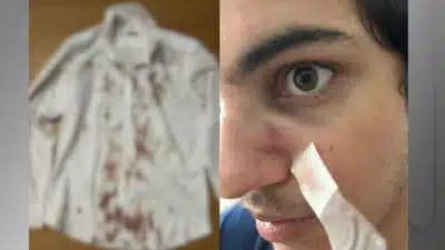 Imagem card com fundo